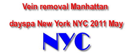 Vein removal manhattan dayspa New York NYC 